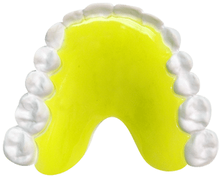 Acrylic- Neon - Yellow retainer