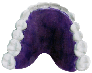 Acrylic- Neon - Purple retainer