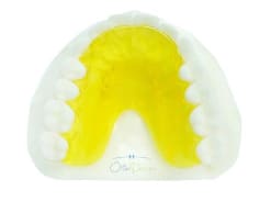 Aligners